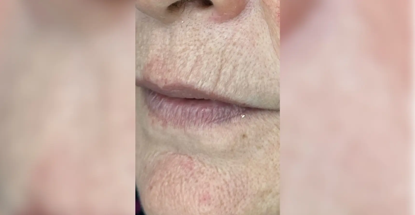 01JER8XSW8ACTKKDEHF5VBFACE